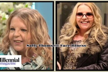 Sally Thomsett Face Illness