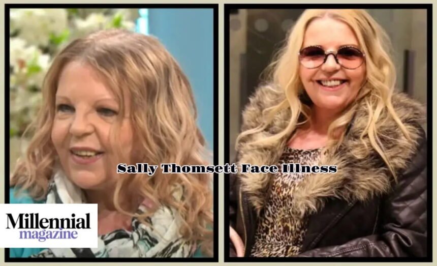 Sally Thomsett Face Illness