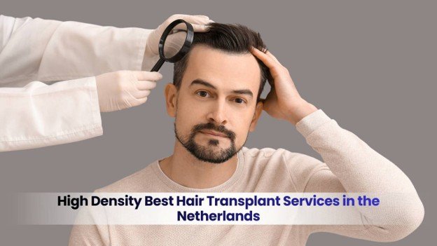 High Density Best Hair Transplant Services in the Netherlands